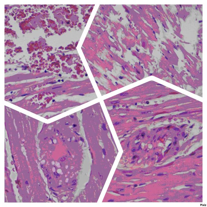 Fig. 1. The Structure of the Left Ventricular Myocardium of Animals on the 5Tth Day