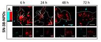 Further Details Revealed About a Highly-efficient Anticancer Drug Delivery System