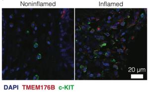 Microscopy images comparing 'quiet' gut tissue (left) and inflamed tissue (right) with labels