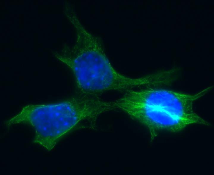 Cancer cells