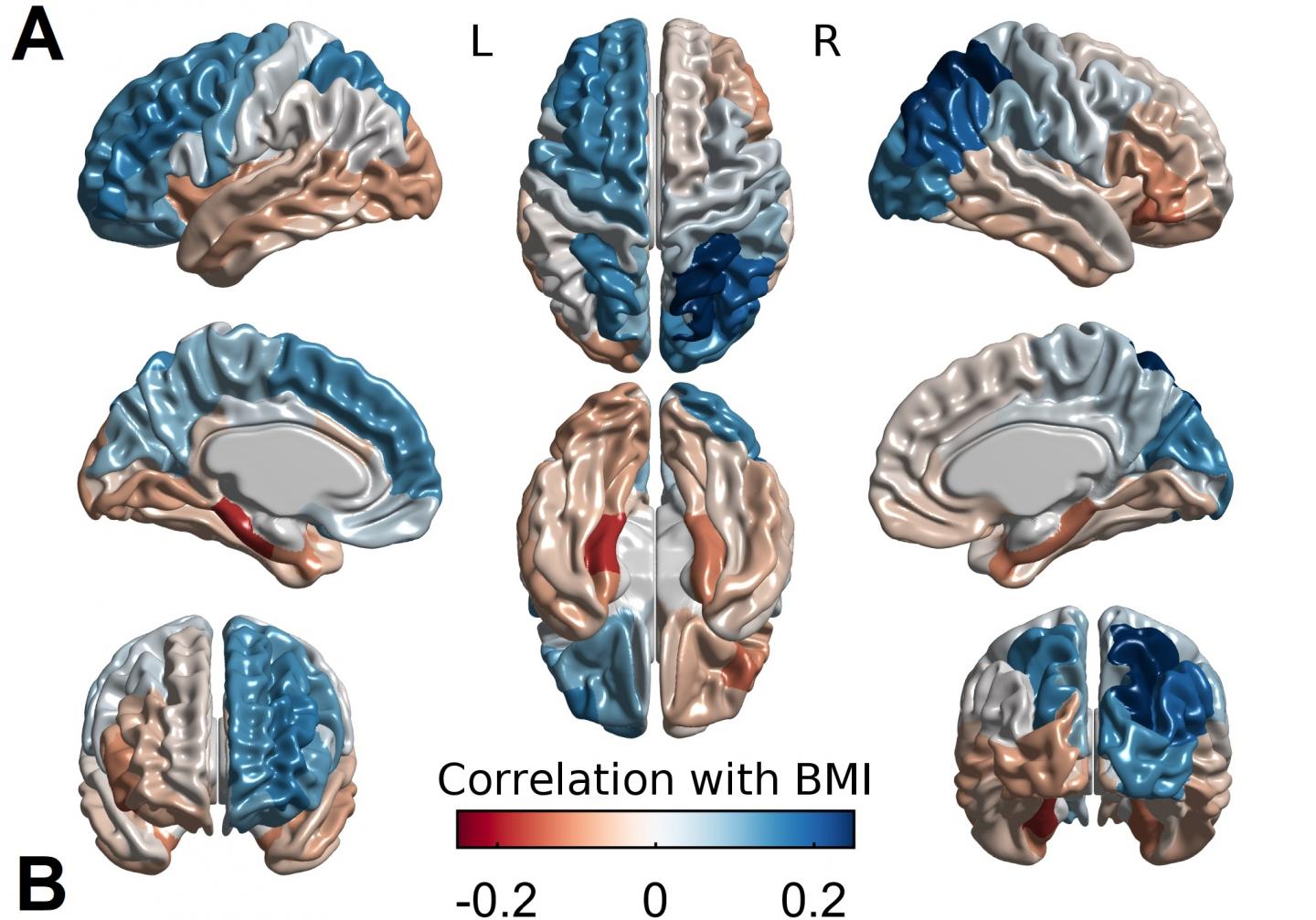 Cortical Thickness