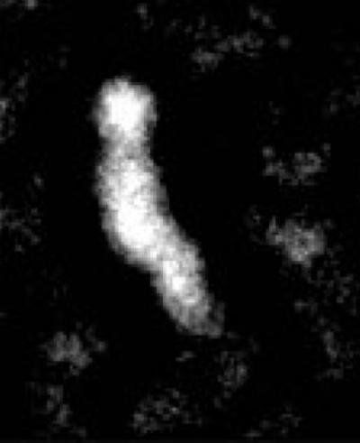 CETP Micrograph