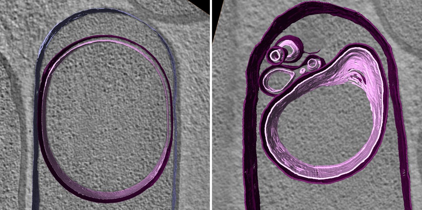 CryoEM of DNA Inflation