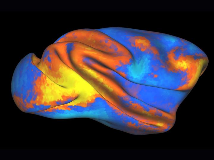 Macaque Brain