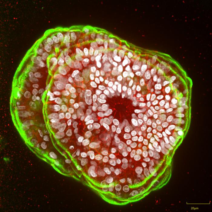 Healthy pancreas organoids