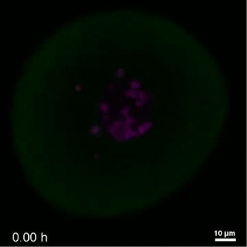 Spindle Assembly Key to Chromosome Errors in Human Eggs (4 of 6)