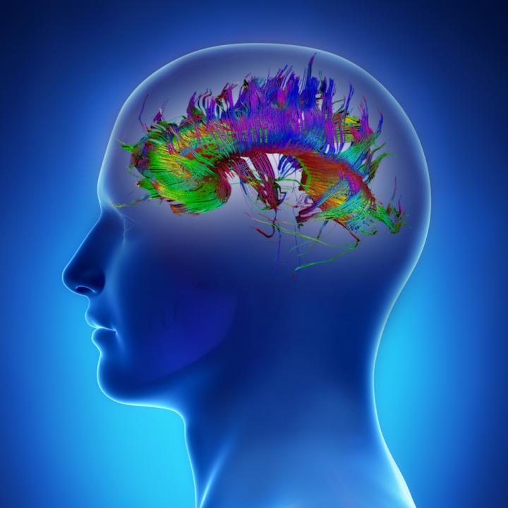 Advanced techniques at the Ortenzio Neuroimaging Center at Kessler Foundation aid progress in research