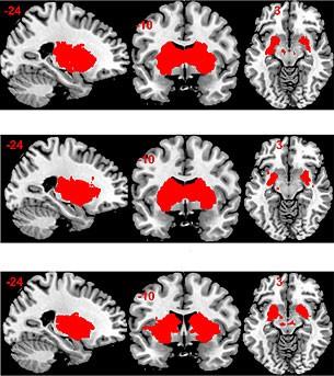 The Brain's Reward System