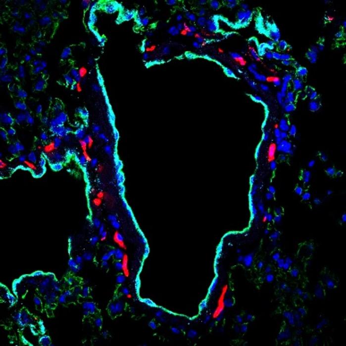 Confocal image of a lung from a tumor-bearing mouse before cancer cells arrive.