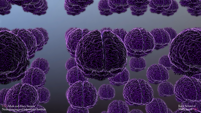 AI and GAAIN - a game-changer in Alzheimer’s research