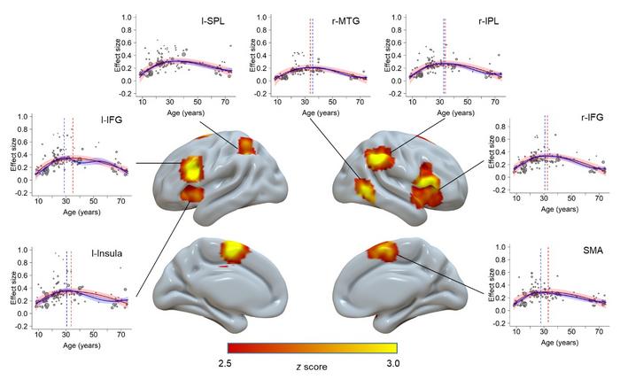 Brain regions showing inverted U-shaped trajectory patterns