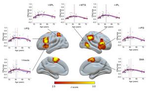 Brain regions showing inverted U-shaped trajectory patterns