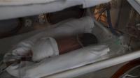 Blocking Light Improves Preemies' Survival Rates (3 of 3)