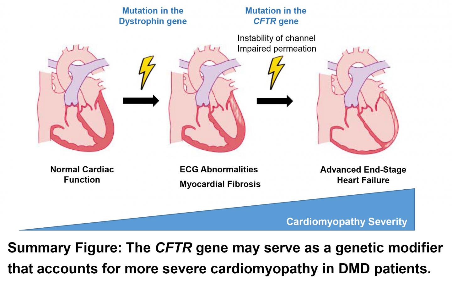 Cardiomyopathy Severity