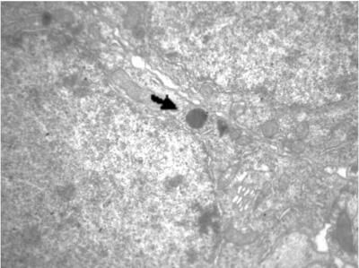 Microscopy