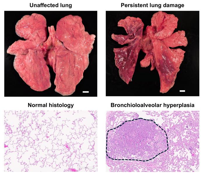 Obesity shapes COVID-19’s long-term damage