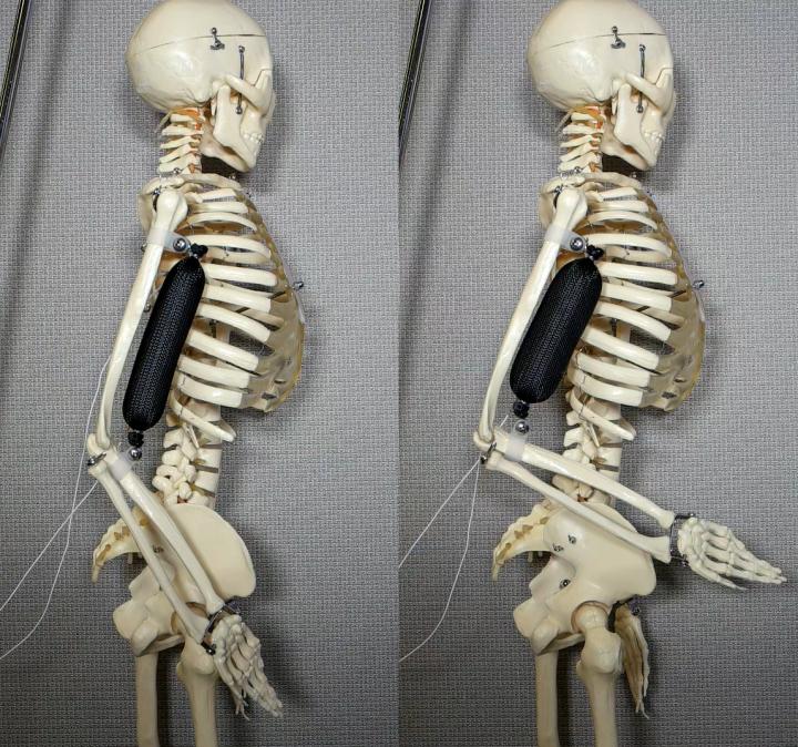 Artificial Muscle