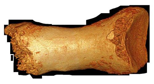 Denisova Neandertal Toe None.