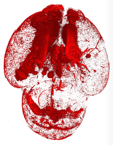 Brain bleeding model