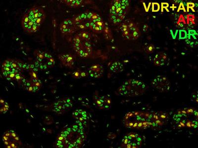 Breast Cells