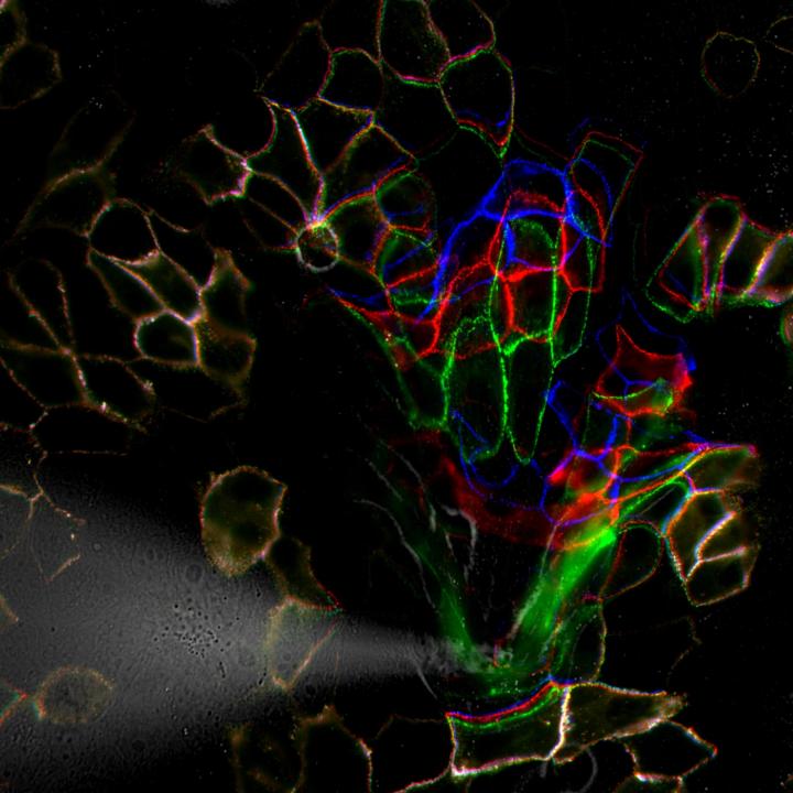How Skin Cells Protect Themselves Against Stress