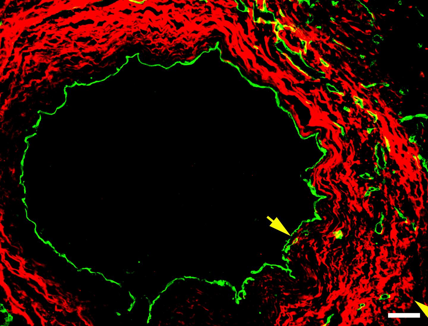 The Receptor that Protects Blood Vessels from Scarring (6 of 6)