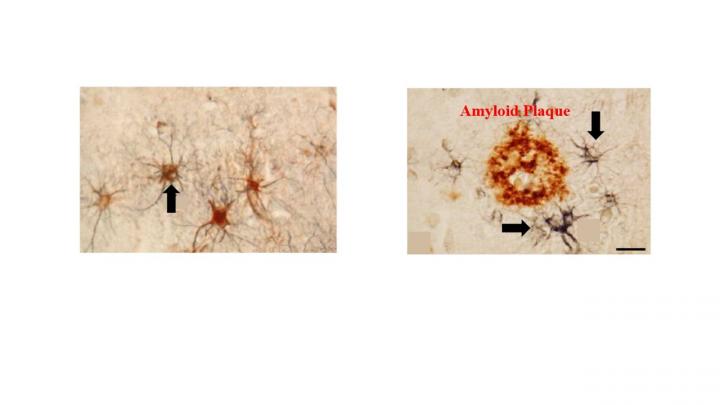 Illustration Atrocytes