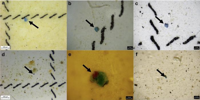 Picture of microplastics from biopsies