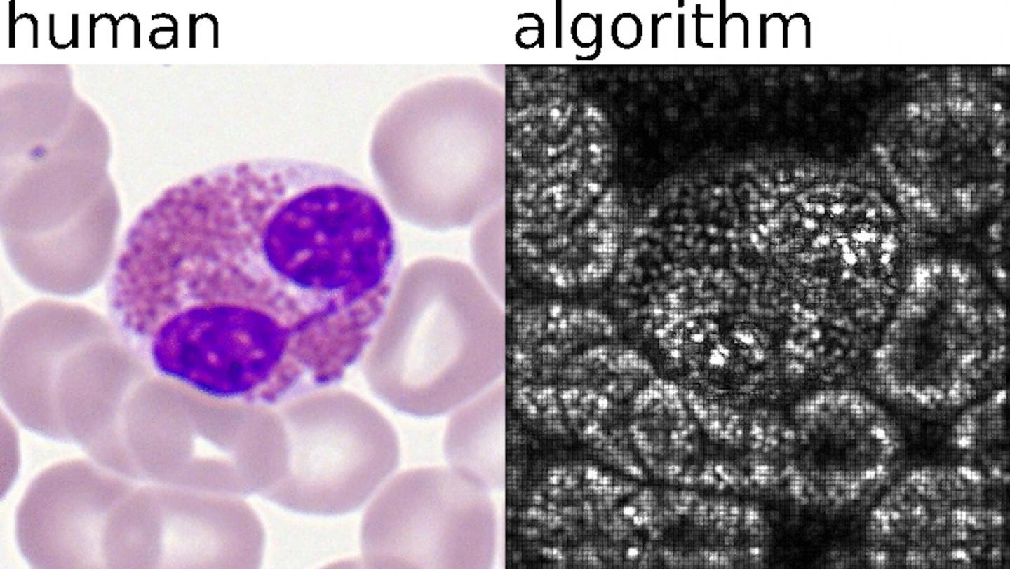 Deep Learning Algorithms of AI Analyzes Samples in An Automated and Standardized Way