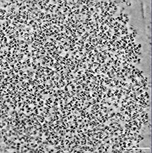Cryo-ET Imaging of a Chromatin Condensate