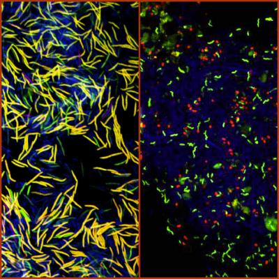 Microscopic Identification of the Microbiota