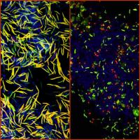 Microscopic Identification of the Microbiota