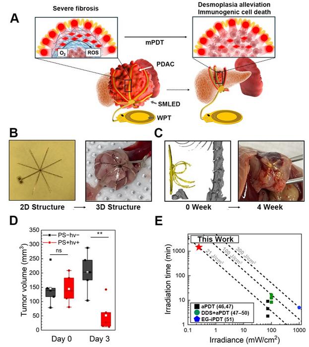 Octopus-Inspired 3D Micro-LEDs Pave the Way for Selective Pancreatic Cancer Therapy​