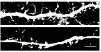 Dendritic Spines