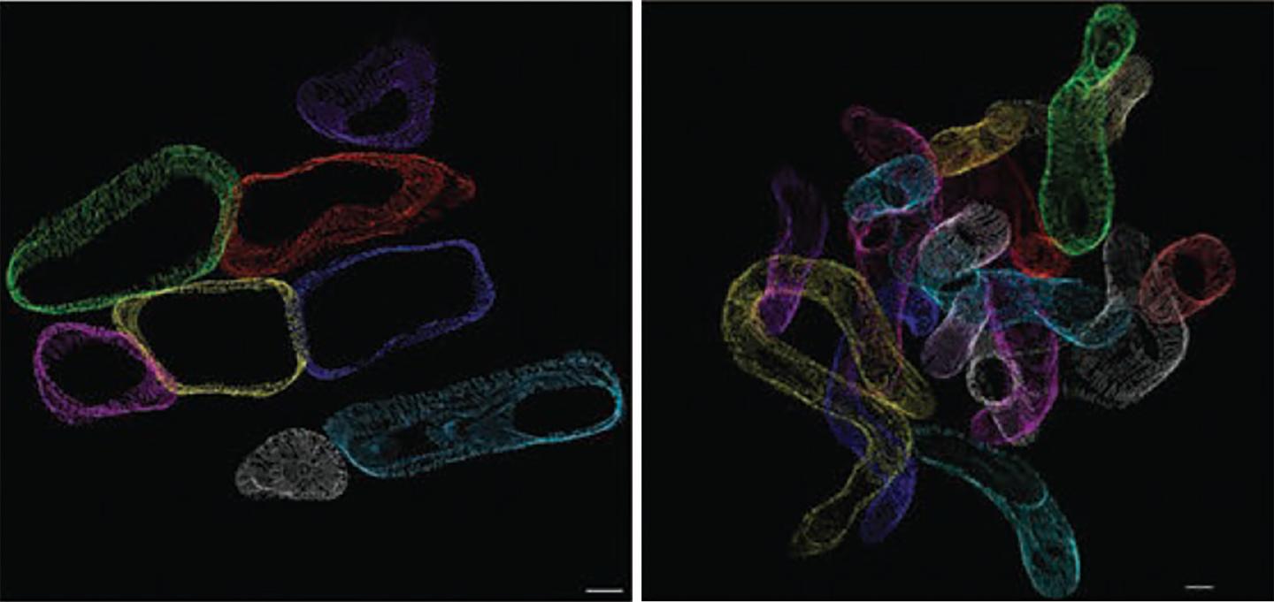 Cardiac Mitochondria