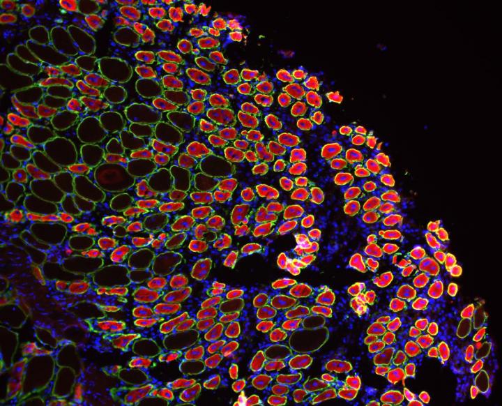 Newly Regenerated Muscle Fibers