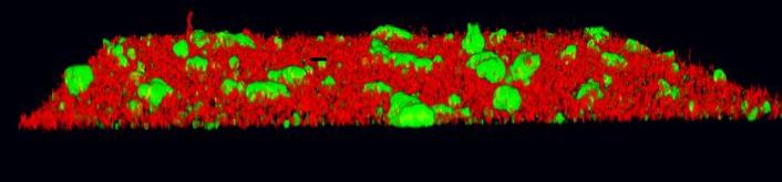 Bacterial Biofilm In The Absence Of Inhibitory Compounds