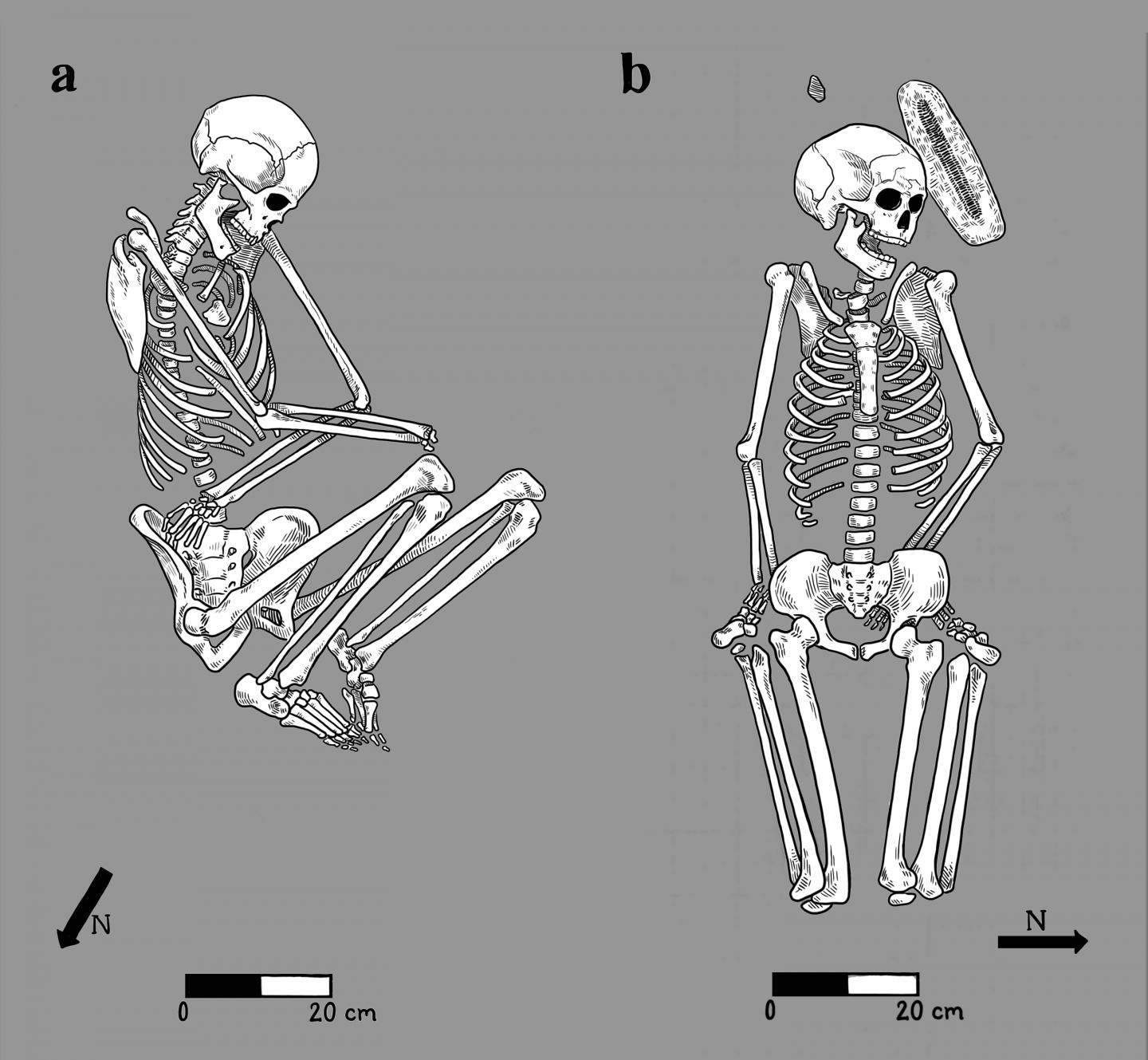 Skeletal Remains