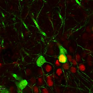 Hippocampus neurons