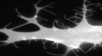 Induction of Filopodia