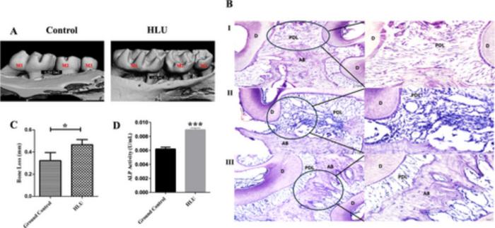 Pancreatic cancer diagnosis