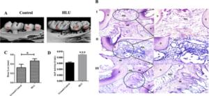 Pancreatic cancer diagnosis