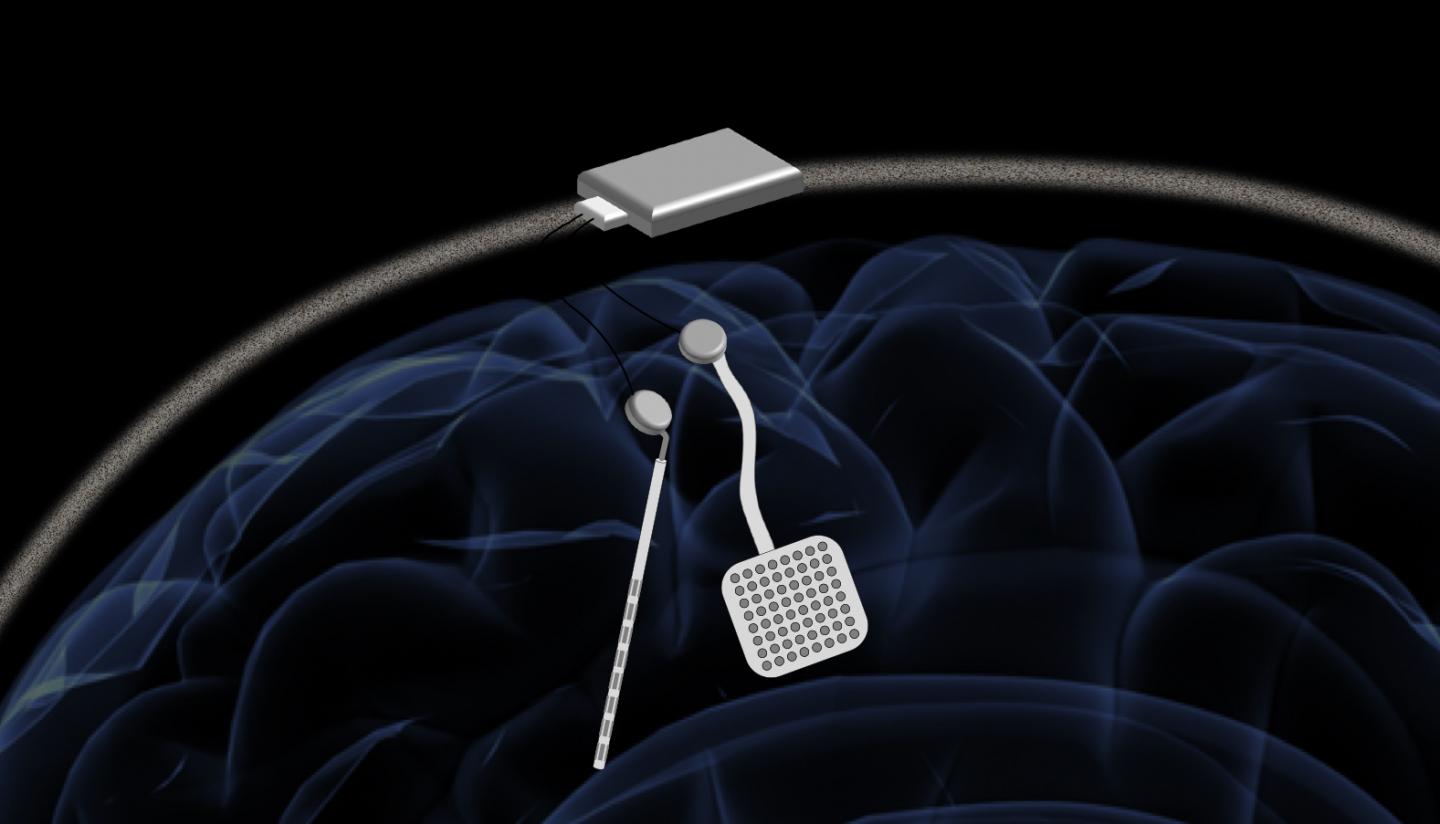 Device on Brain