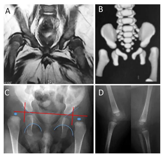 Radiological Features
