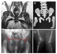 Radiological Features