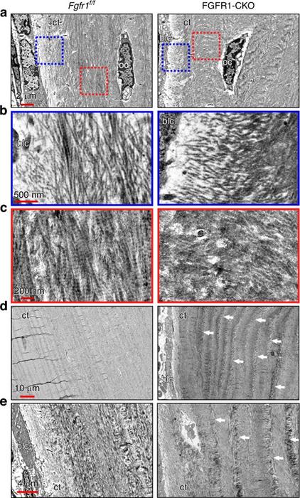 FGFR1 loss disrupts the structure of newly forming bone matrix
