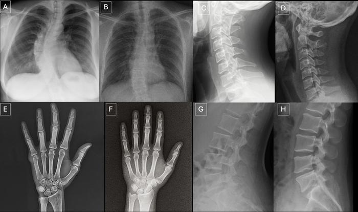 Anatomy-matched real and GPT-4o-generated X-rays