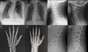 Anatomy-matched real and GPT-4o-generated X-rays