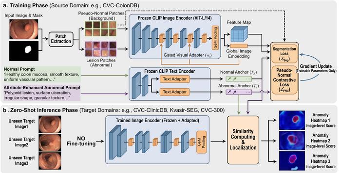 Overview of the proposed zero-shot colorectal polyp detection framework