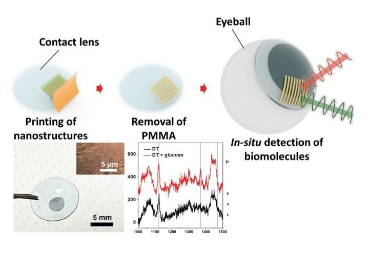 Glucose Contact Lens